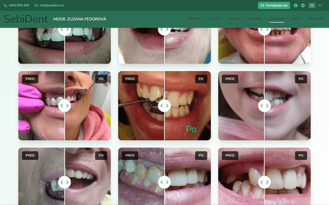 SebiDent gallery page with before and after treatment comparison sliders